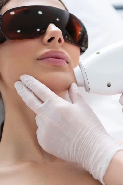 jmed spa candela laser hair removal treatment