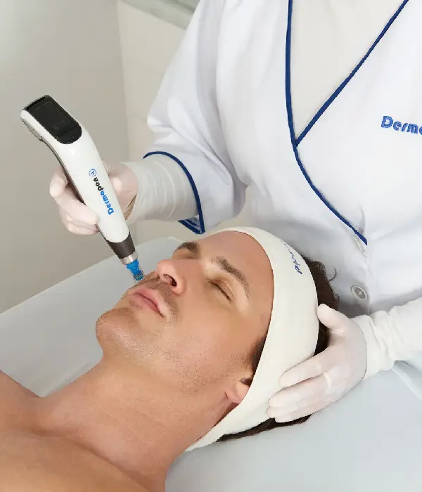 jmed spa dermapen treatment