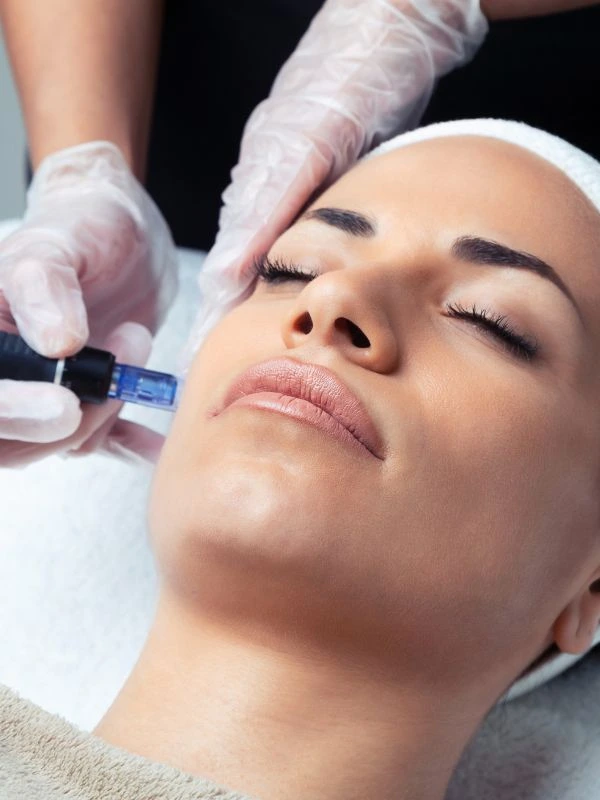 jmed spa acne and scar treatment