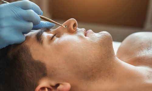 jmed spa blackhead removal